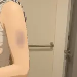 DV被害の実態を写真の証拠と共に語ってくれた。